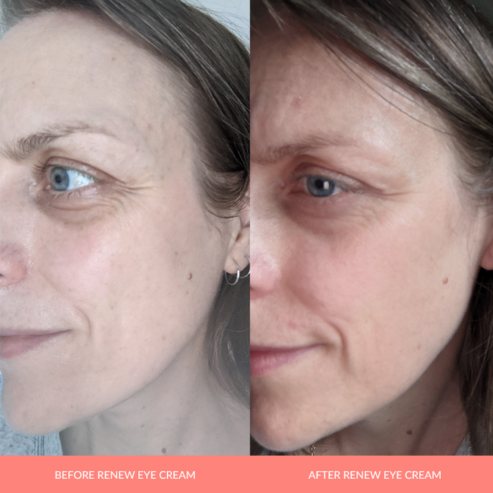 Renew Eye Cream