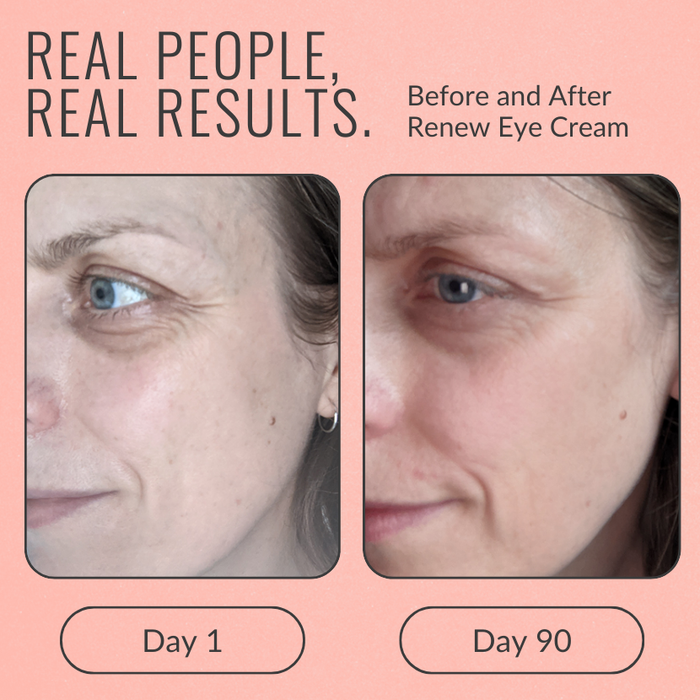 Renew Eye Cream