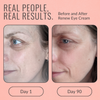 Renew Eye Cream