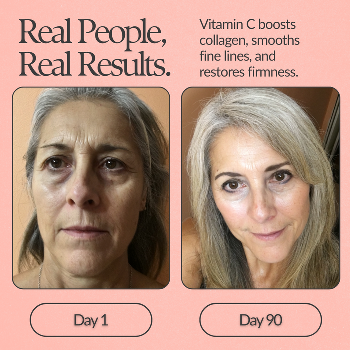 Restore Vitamin C Serum