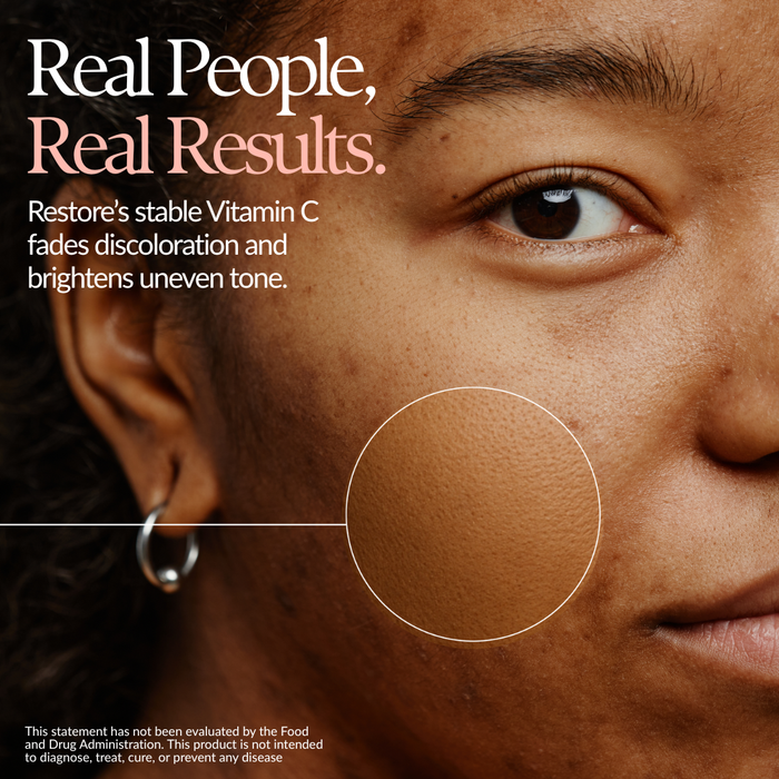 Restore Vitamin C Serum