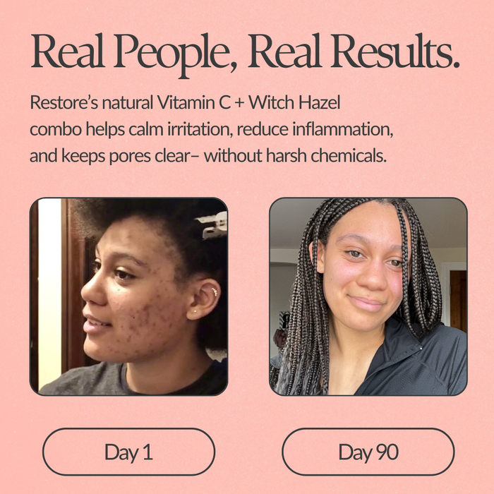 Restore Vitamin C Serum