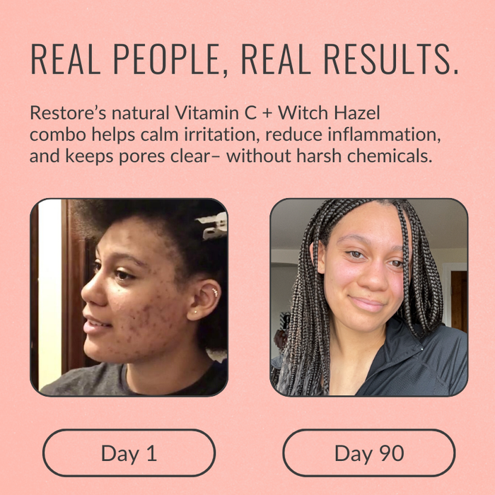 Restore Vitamin C Serum