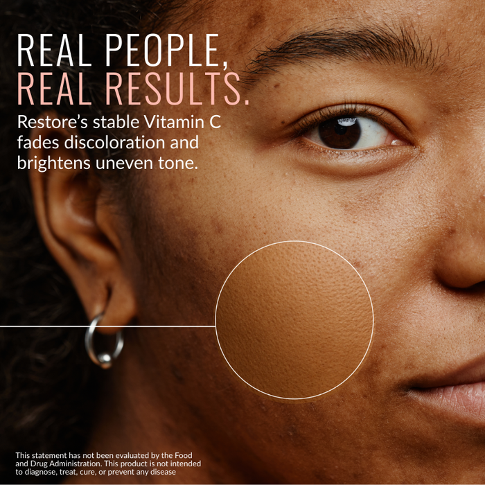 Restore Vitamin C Serum